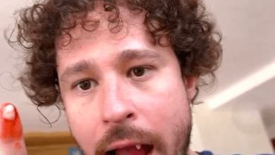 Photo of Se le “caen” los dientes a Luisito Comunida en plena transmisión 